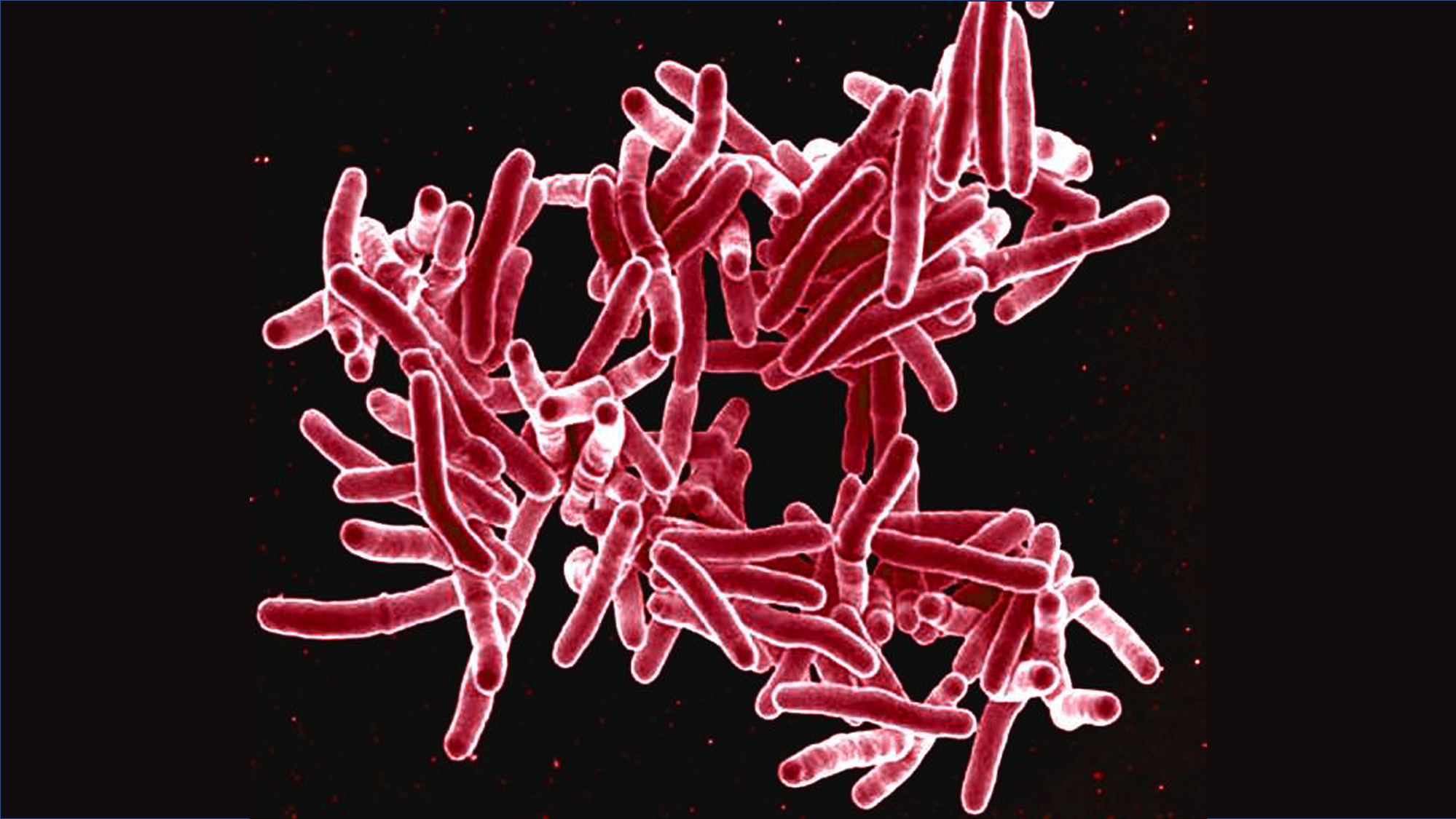 Возбудитель инфекции туберкулеза